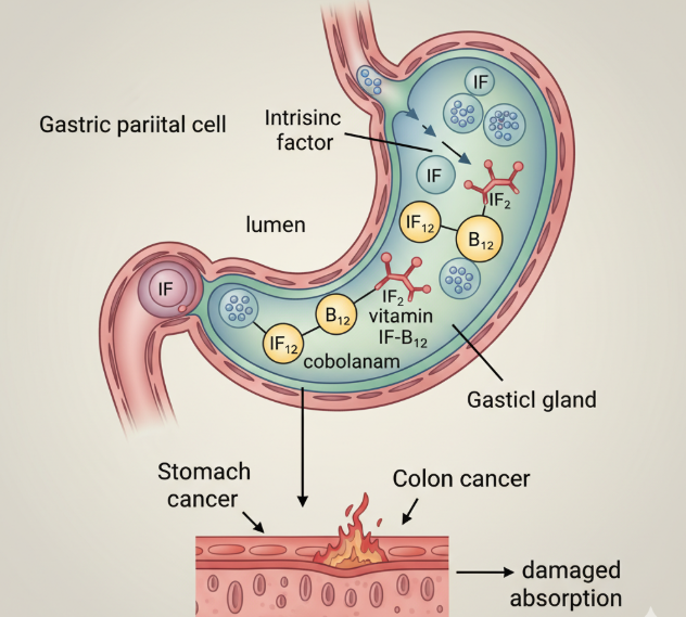 El proceso de combinación del Factor Intrínseco con la B12